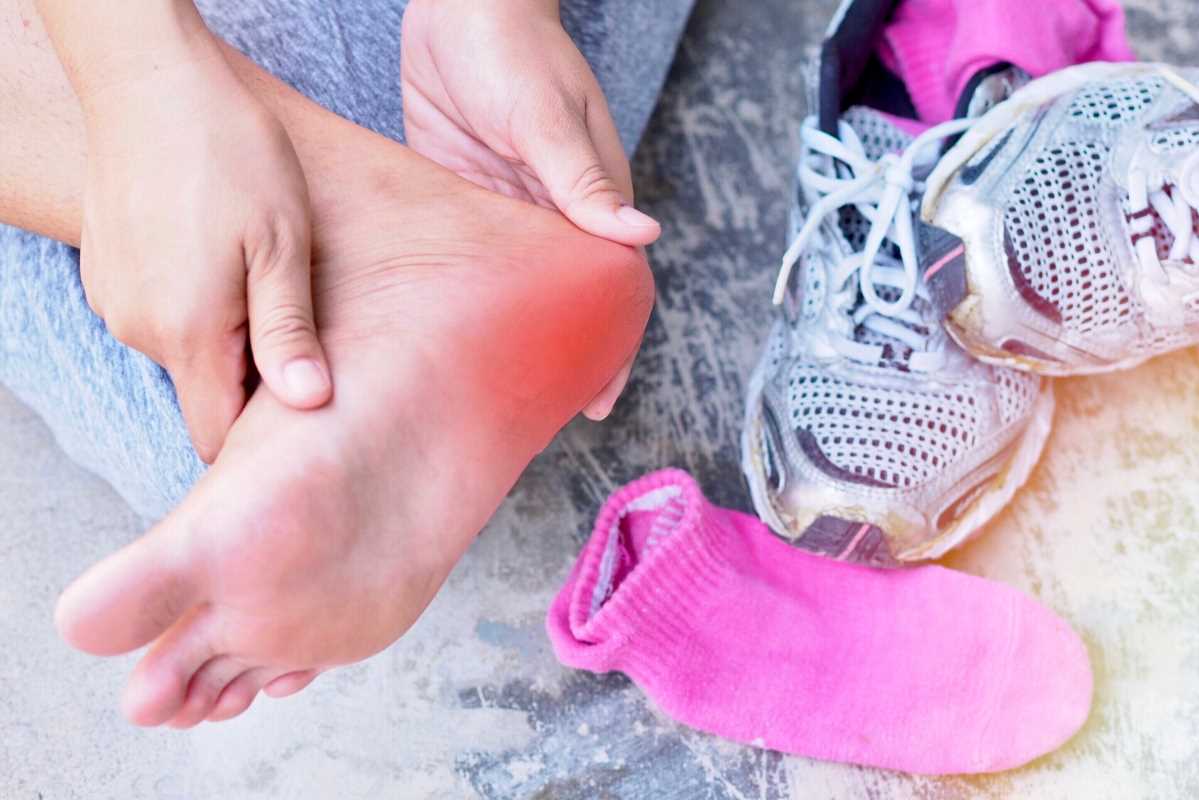 7 Antifungal Medications for Athlete's Foot